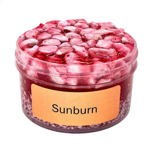 Sunburn